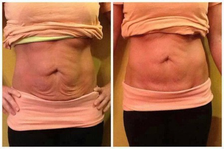 Defining Gel sur 2 mois